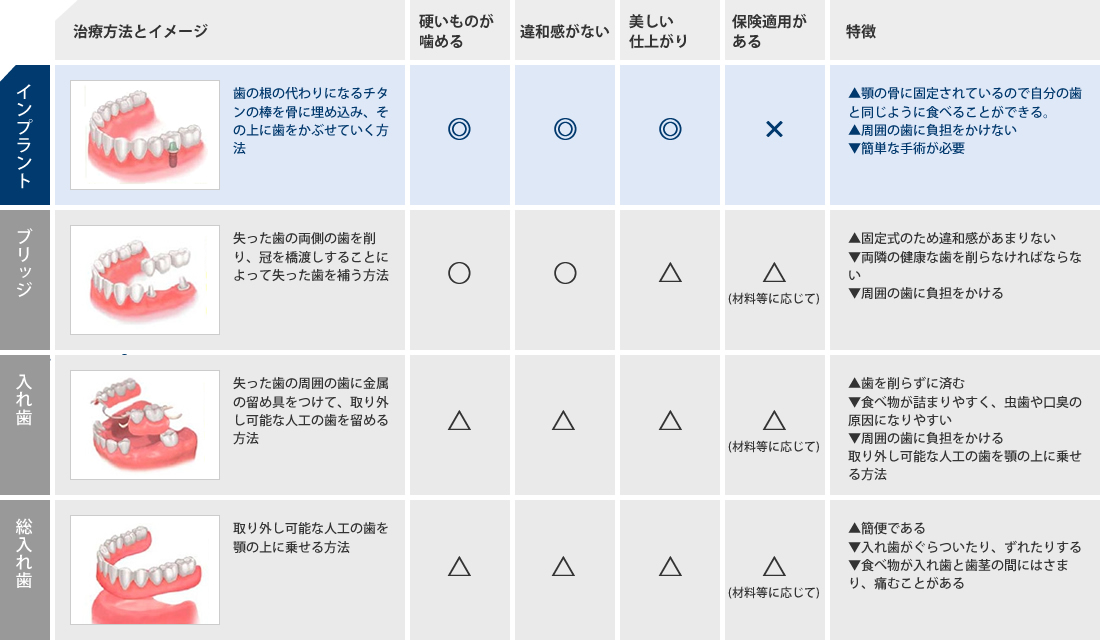 インプラントと他の治療方法との比較表