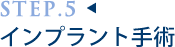 インプラント手術