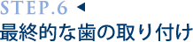 最終的な歯の取り付け